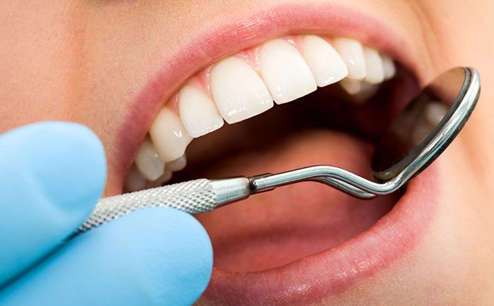 Comment prendre soin de ses dents au quotidien ?