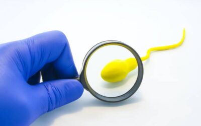 Sperme jaune : signification, causes et traitements d’un sperme jaunâtre